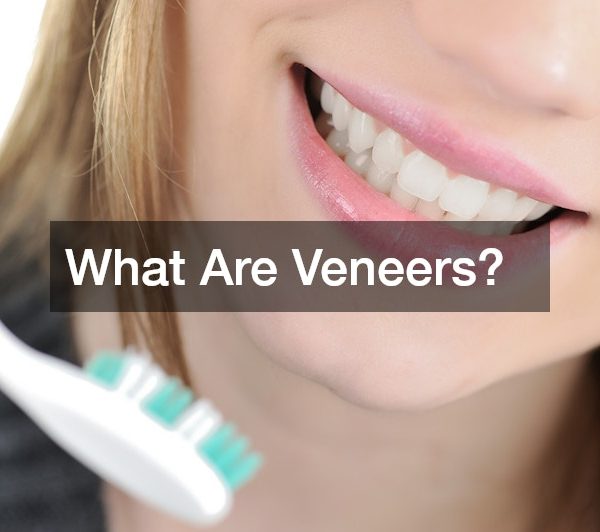 What Are Veneers?