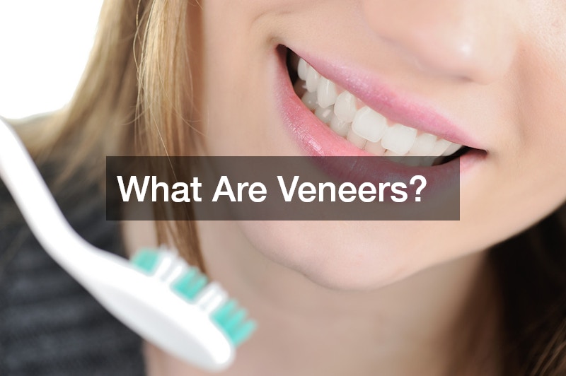 What Are Veneers?