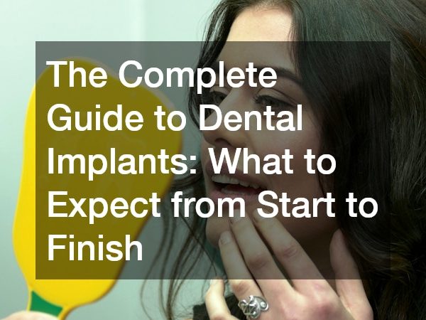 The Complete Guide to Dental Implants What to Expect from Start to Finish